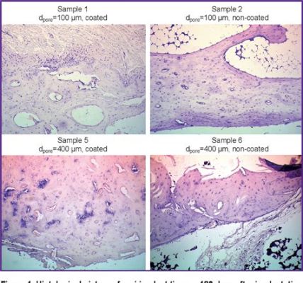  Calciumfosfaat: Biocompatibiliteit en Osseointegratie voor een Sterker Toekomst!