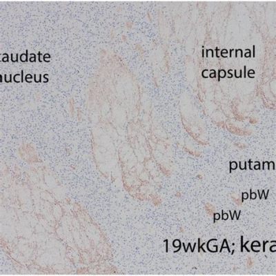  Keratan Sulfate voor Versterkte Kunststofconstructies en Optimale Biocompatibiliteit!